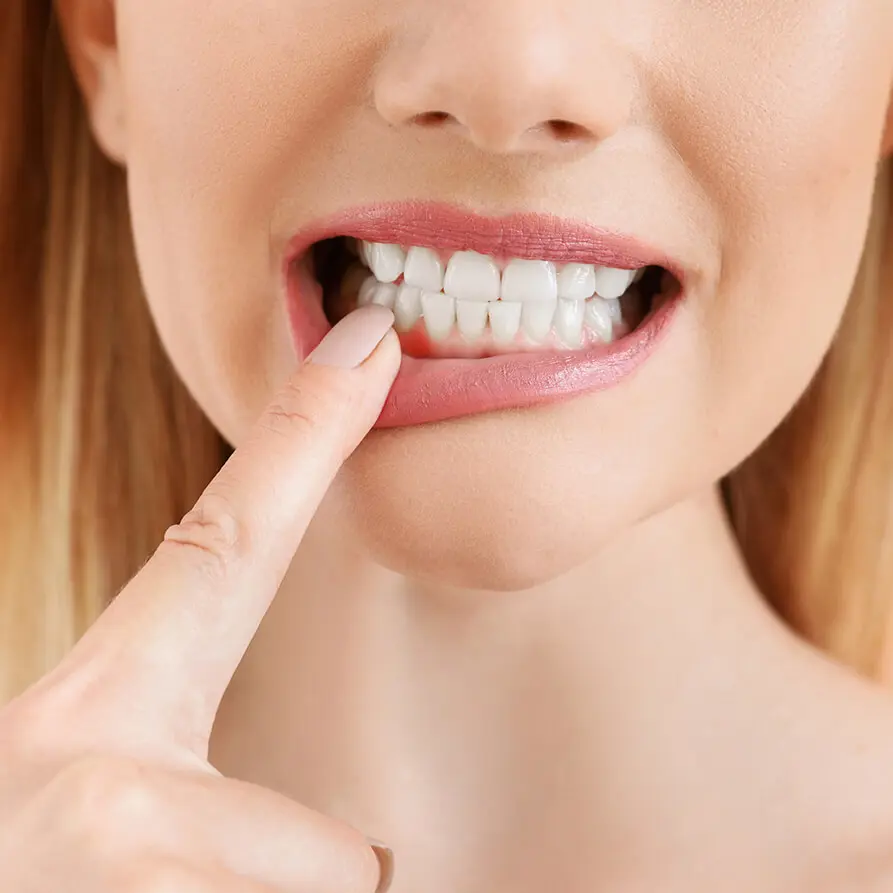 Žena kontroluje ďasná