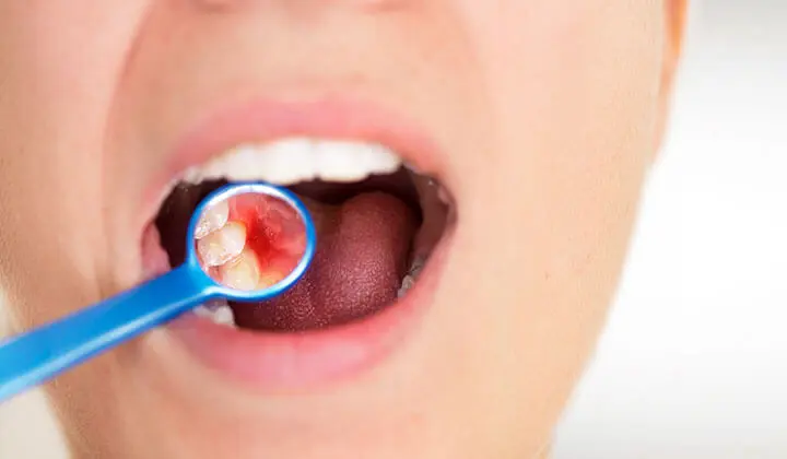 Problems with the oral mucosa