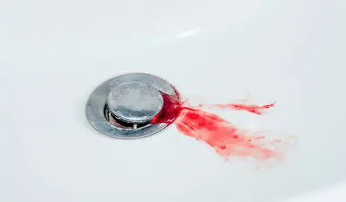 Bleeding gums can have various causes